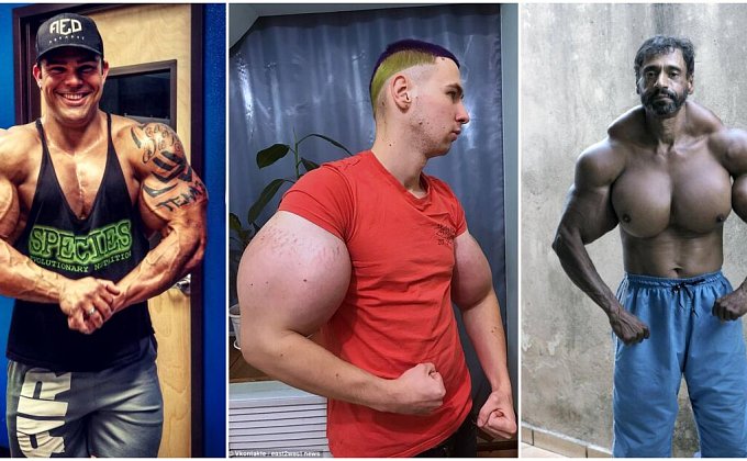 Hazard se zdravím: Synthol může způsobit amputaci končetin či smrt