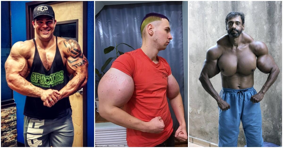 Hazard se zdravím: Synthol může způsobit amputaci končetin či smrt